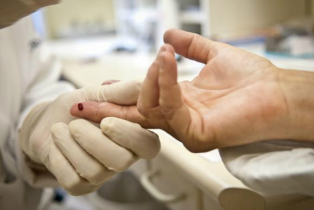 Jovens com HIV relatam avanços na qualidade de vida e destacam prevenção Teste para detectar o vírus HIV (Arquivo/Agência Brasil)