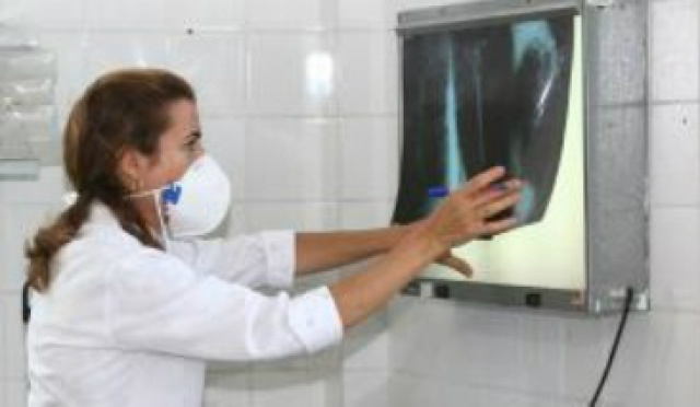 A OMS estima a existência de 9 milhões de casos de tuberculose em todo o mundo (Agecom Bahia)