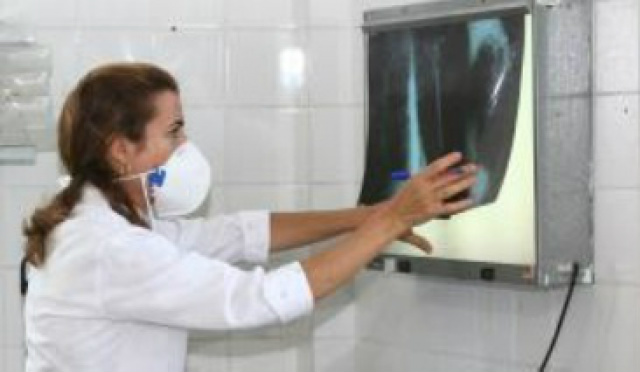 Casos de tuberculose no Brasil caem 20,3% em dez anos A OMS estima a existência de 9 milhões de casos de tuberculose em todo o mundo (Agecom Bahia)