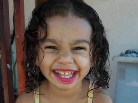 Em Três Lagoas, menina de 3 anos tem perna amputada depois de ser atropelada Criança foi atropelada no bairro Vila Haro. (Foto: Reprodução/Facebook).
