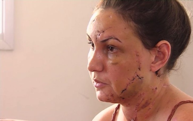 Estudante conta que namorado a agrediu e depois se matou com caco de vidro em motel Estudante Pollyana Cristine Carvalho, 32 anos, diz que foi agredida por namorado em motel Goiânia Goiás (Foto: TV Anhanguera/Reprodução)