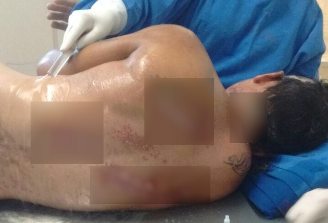 'Meu coração era pra ter explodido', diz vítima de choque 270 vezes maior que voltagem da tomada Homem sobreviveu a choque de 30 mil volts, diz família em Campo Grande - MS (Foto: João Paulo Souza/Arquivo Pessoal)