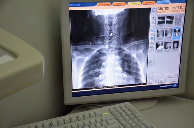 Raio-X volta a funcionar nas unidades de Saúde de Três Lagoas Na UPA – 24h, conforme relatórios da SMS, de janeiro até agora, foram realizados 2.438 exames Radiodiagnósticos. (Foto: Divulgação)