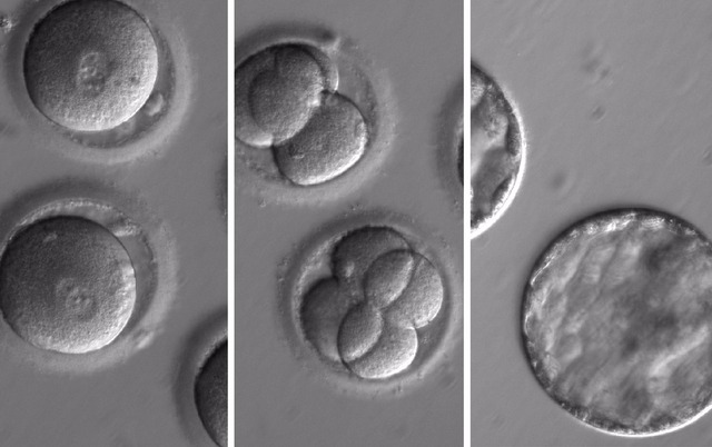 Sequência de imagens mostra o desenvolvimento de embriões após injeção de uma enzima de correção de genes e esperma de um doador com uma mutação genética conhecida por causar cardiomiopatia hipertrófica. (Foto: Nature/OHSU)
