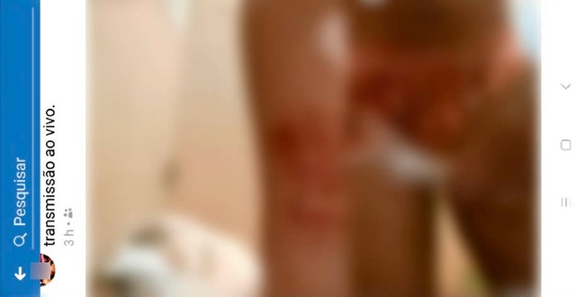 Adolescente de 15 anos se automutila em transmissão ao vivo na rede social Transmissão foi apagada depois da repercussão negativa do vídeo - Foto: Foto: Reprodução
