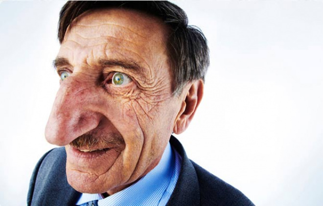 Veja lista com recordes humanos inusitados Turco Mehmet Ozyurek ostenta um nariz de 8,8 centímetros. (Foto: Reprodução/Guinness)