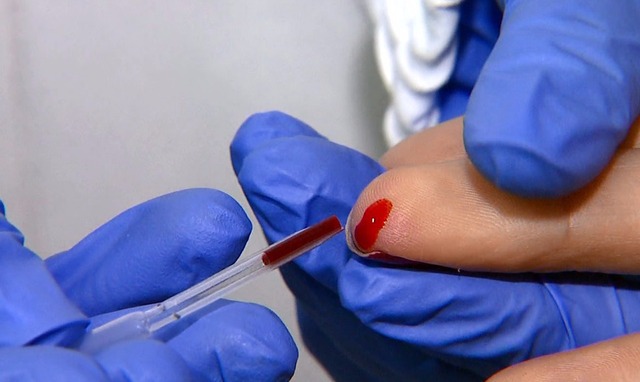 SUS inclui teste rápido para dengue e chikungunya Testes rápidos são oferecidos para quem apresentar sintomas das condições (Foto: Reprodução EPTV)