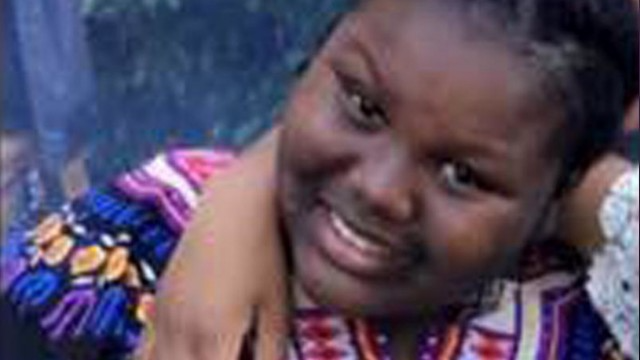 Menina de 11 anos fica desfigurada após ser acordada com água fervendo Jamoneisha estava descansando no momento em que foi atacada Foto: Reprodução/Facebook