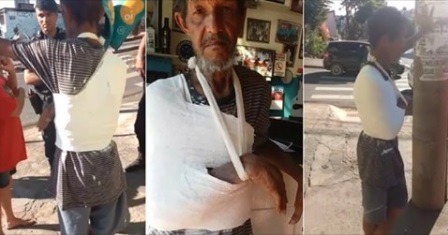 Homem tem braço engessado por cima de roupa Homem é engessado por cima da roupa em Belo Horizonte (Foto: Reprodução/Internet)
