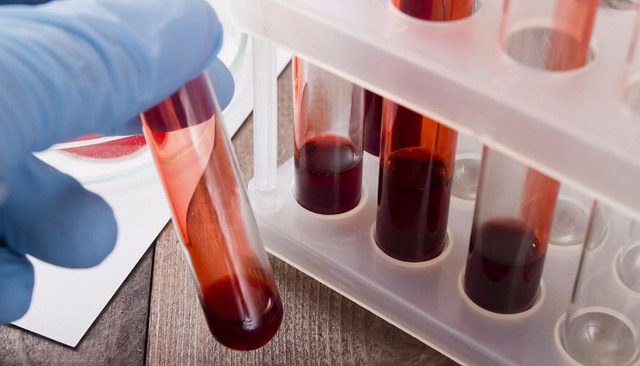 Cientistas criam exame de sangue capaz de detectar câncer precocemente Foto/Divulgação