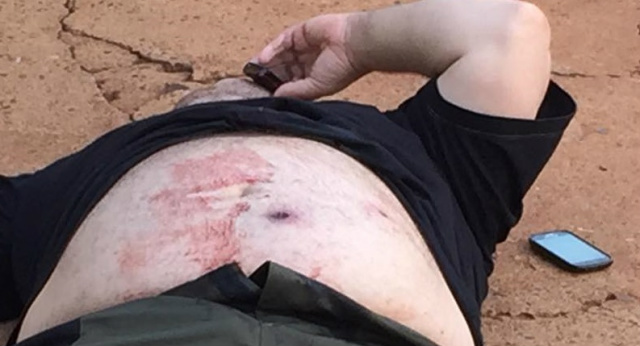 Mãe de rapaz baleado pelo irmão diz que pivô foi a mulher do autor A vítima mesmo baleado com quatro tiros ainda encontrou forças para acionar o socorro e ligar para a mão que estava em férias na Bahia (Foto: Marco Campos)