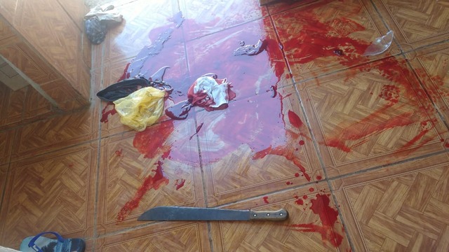 Filho acerta a cabeça do pai com facão no Interlagos Homem perdeu muito sangue antes de ser socorrido. Foto: Divulgação/Corpo de Bombeiros.