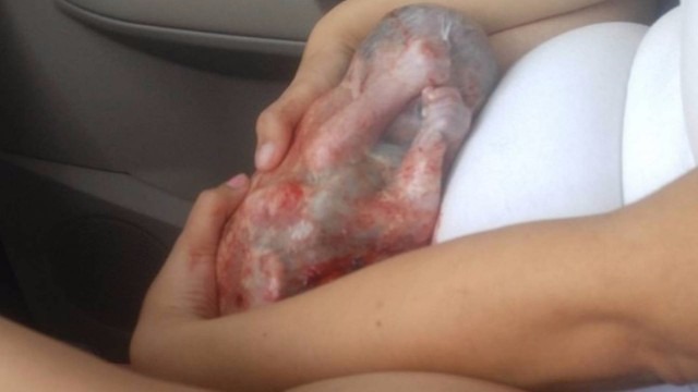 Mulher faz próprio parto e bebê nasce em bolsa amniótica intacta O pequeno Ean nasceu dentro da bolsa amniótica intacta (Foto: Reprodução/Instagram)