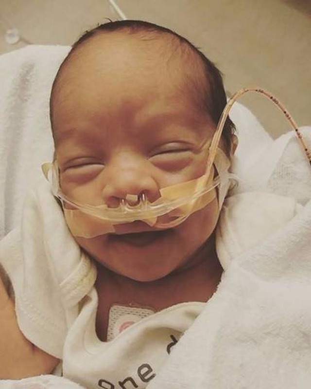 Mulher faz próprio parto e bebê nasce em bolsa amniótica intacta O pequeno Ean Junior está se recuperando Foto: Reprodução/Extra