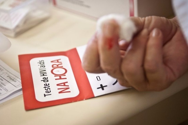 Especialistas discutem cura da Aids e alertam para diagnóstico da hepatite C A expectativa, é que em até 10 anos essas pesquisas resultem em medicamentos que levem à cura da aids