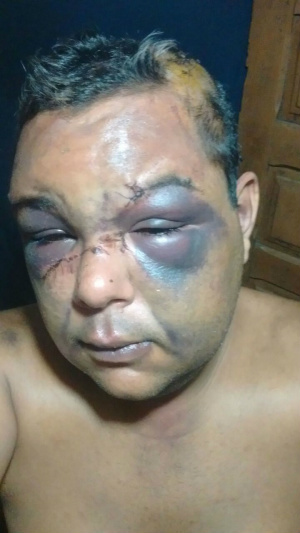 A vítima levou 32 pontos na cabeça, ficou com vários hematomas pelo rosto. (Foto: Arquivo pessoal).