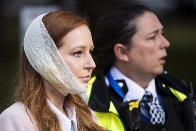 Chega a 22 número de feridos no metrô de Londres; polícia vê ato terrorista Passageira do metrô de Londres fica ferida em explosão . (Foto: Divulgação Agência EFE)