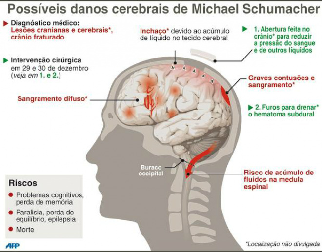 Schumacher está sendo tratado no hospital da Universidade de Grenoble, na França, e segue em coma induzido (Foto: Terra)